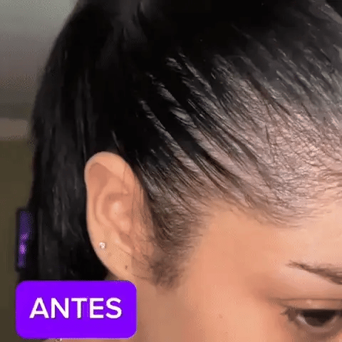 GOMAS DE BIOTIONA SIN AZUCAR (FORTACELE PELO Y UÑAS)💅🏻💇🏻♀️ - LLEVALAS EN COMBO CON GOMAS DE MELATONINA (PARA DORMIR MEJOR) 🌙💤 - ENVIO GRATIS 🤩